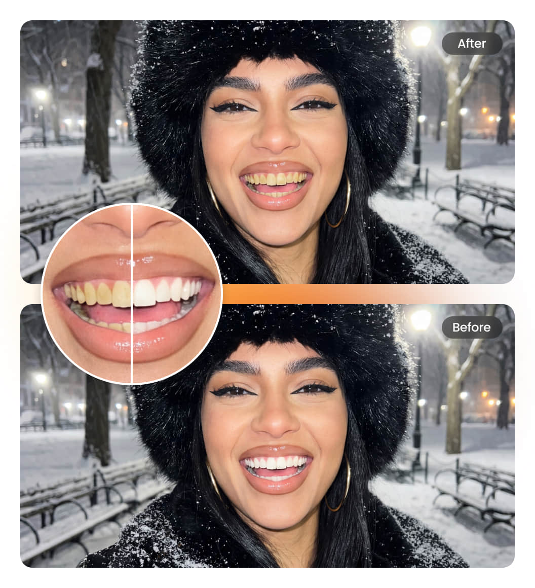 Teeth Whitening in Photo 